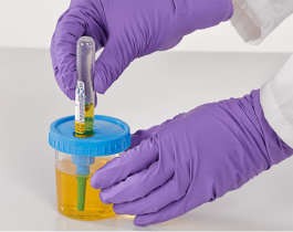 vacutainer-ua-preservative-tubes_C_PAS_UC_0616-0016.png