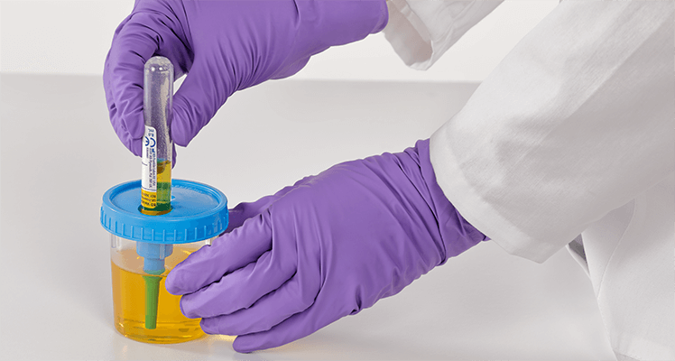 vacutainer-urine-cup_C_PAS_UC_0616-0016.png