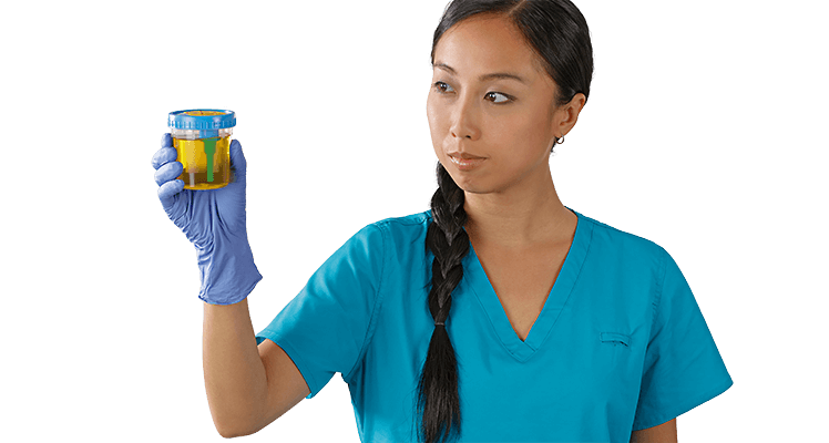 vacutainer-urine-cup_C_PAS_UC_0616-0019.png