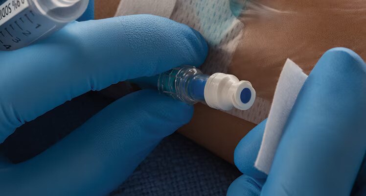 smart-site-needle-free-connector_RC_VA_0517-1251.jpg