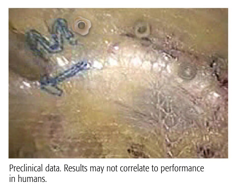 Strong Repair  
