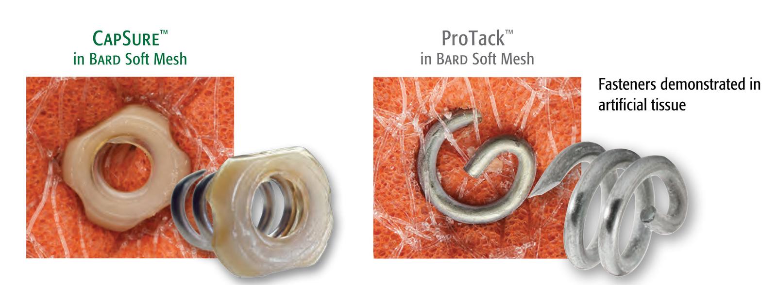 CapSure™ Fasteners