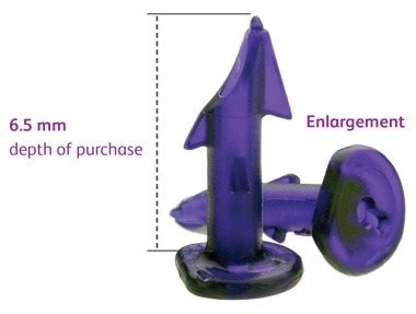 Absorbable poly (L-lactide-co-glycolide) PLG fastener1