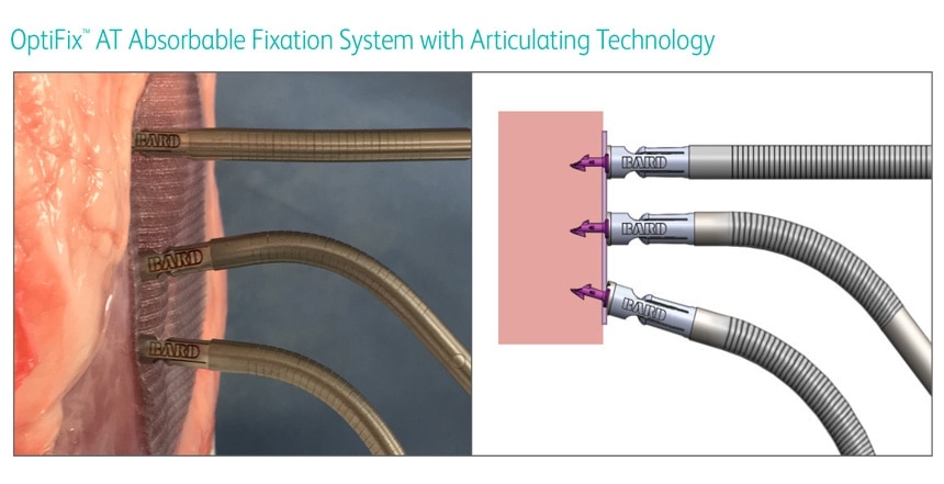 Consistent perpendicular fastener deployment1  