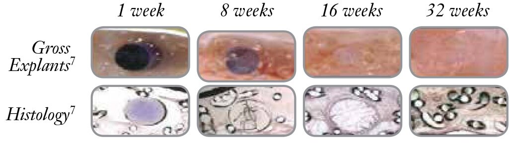 Conception