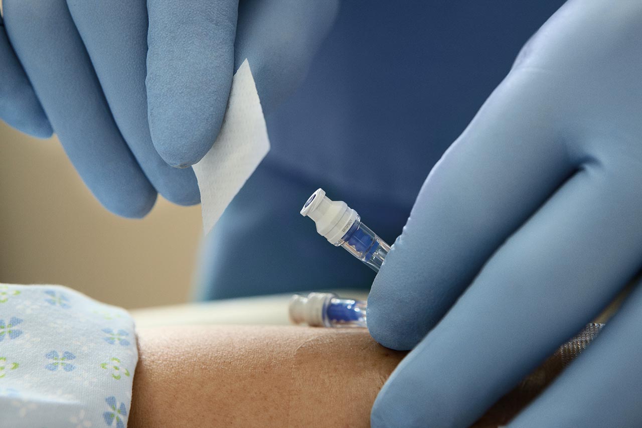 Peripheral-IV-SmartSite_0501-2