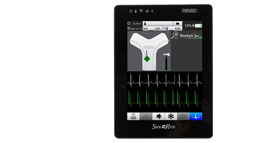 site-rite-8-p-wave